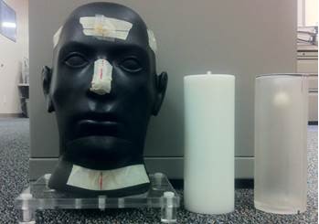 Stereotactic Radiosurgery Head Phantom